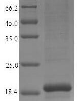 Human Cystatin-9 (CST9) Recombinant Protein - BioCrest Sci