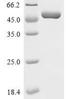 Stenotrophomonas maltophilia UDP-N-acetylglucosamine 1-carboxyvinyltransferase (murA) Recombinant Protein - BioCrest Sci