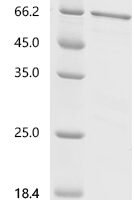Human Chromogranin-A (CHGA) Recombinant Protein, C-10His, aa 19–457, Mammalian cell - BioCrest Sci