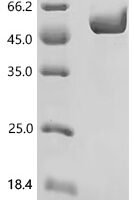 Human Acyl-coenzyme A thioesterase 9, mitochondrial (ACOT9) Recombinant Protein, C-His, aa 22–439, E.coli - BioCrest Sci