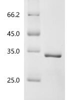 Human Small ribosomal subunit protein eS27 (RPS27) Recombinant Protein - BioCrest Sci