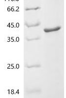 Chicken Bifunctional purine biosynthesis protein ATIC (ATIC), partial Recombinant Protein - BioCrest Sci