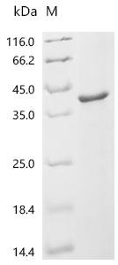 Chicken Bifunctional purine biosynthesis protein ATIC (ATIC), partial Recombinant Protein, Gallus gallus (Chicken), E.coli, C-terminal 6xHis-tagged, 38.8 kDa, purity >≥ 85% as determined by SDS-PAGE.