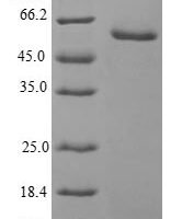 Human Ubiquitin-conjugating enzyme E2 S (UBE2S) Recombinant Protein - BioCrest Sci