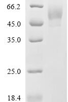 Capsicum pepper Glucan endo-1,3-beta-glucosidase, basic vacuolar isoform Recombinant Protein - BioCrest Sci