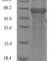 Hesperocyparis arizonica Pectate lyase 1 Recombinant Protein - BioCrest Sci