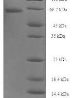 Clostridium botulinum Botulinum neurotoxin type A (botA), partial Recombinant Protein - BioCrest Sci