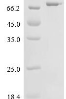Mouse Anti-Muellerian hormone (Amh) Recombinant Protein - BioCrest Sci
