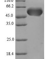Human Protein AATF (AATF), partial Recombinant Protein - BioCrest Sci