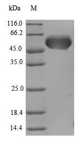 Human Protein AATF (AATF), partial Recombinant Protein, Homo sapiens (Human), E.coli, N-terminal GST-tagged, 58.8 kDa, purity >≥ 90% as determined by SDS-PAGE.