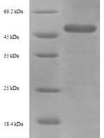 Influenza A virus Hemagglutinin (HA) Recombinant Protein, N-His-SUMO - BioCrest Sci