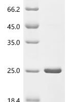 Escherichia coli O157:H7 Translation initiation factor IF-2 (infB), partial Recombinant Protein - BioCrest Sci