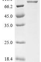 Human Forkhead box protein O1 (FOXO1) Recombinant Protein - BioCrest Sci