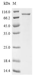 Human Forkhead box protein O1 (FOXO1) Recombinant Protein, Homo sapiens (Human), E.coli, C-terminal 6xHis-tagged, 77.2 kDa, purity >≥ 85% as determined by SDS-PAGE.