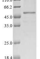 Human Interferon regulatory factor 1 (IRF1)(C83S) Recombinant Protein, N-10His/C-Myc, aa 1–325 (C83S), Baculovirus - BioCrest Sci