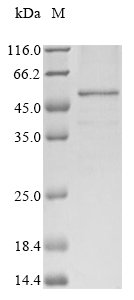 Human Interferon regulatory factor 1 (IRF1)(C83S) Recombinant Protein, N-10His/C-Myc, aa 1–325 (C83S), Baculovirus, Homo sapiens (Human), Baculovirus, N-terminal 10xHis-tagged and C-terminal Myc-tagged, 40.4 kDa, purity >≥ 85% as determined by SDS-PAGE.