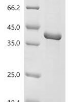Candida albicans Agglutinin-like protein 3 (ALS3), partial Recombinant Protein, C-His, aa 18–330 - BioCrest Sci