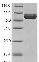 Danio rerio Hydroxylysine kinase (hykk) Recombinant Protein - BioCrest Sci