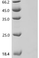Rat Ectonucleotide pyrophosphatase/phosphodiesterase family member 7 (Enpp7), partial Recombinant Protein, N-His-SUMOstar - BioCrest Sci