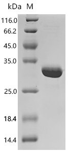 Human Agrin(AGRN), partial Recombinant Protein, Homo sapiens (Human), E.coli, C-terminal 6xHis-tagged, 28.2 kDa, purity >≥ 95% as determined by SDS-PAGE.