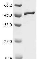 Rice tungro bacilliform virus Polyprotein, partial Recombinant Protein - BioCrest Sci