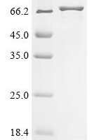 Coxiella burnetii Hypothetical membrane spanning protein (CBU_1863), partial Recombinant Protein, N-His-GST - BioCrest Sci