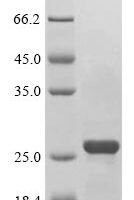 Mouse BCL2/adenovirus E1B 19 kDa protein-interacting protein 3 (Bnip3), partial Recombinant Protein - BioCrest Sci