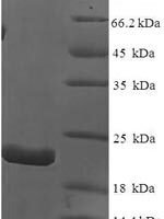 Dog Interleukin-18 (IL18) Recombinant Protein, N-His - BioCrest Sci