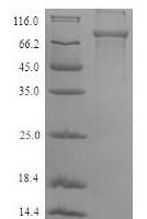 Human Plastin-2 (LCP1) Recombinant Protein, N-His-SUMO - BioCrest Sci