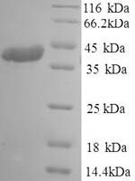 Human coronavirus OC43 Spike glycoprotein (S), partial Recombinant Protein, N-His - BioCrest Sci