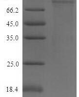 Mouse Desmoglein-2 (Dsg2), partial Recombinant Protein - BioCrest Sci