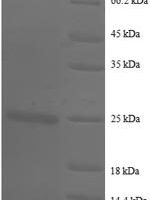 Human Basigin (BSG), partial Recombinant Protein, N-His - BioCrest Sci