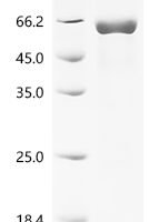 Rat Pulmonary surfactant-associated protein A (Sftpa1) Recombinant Protein - BioCrest Sci