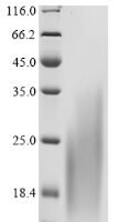 Human C-C chemokine receptor type 8 (CCR8), partial Recombinant Protein - BioCrest Sci