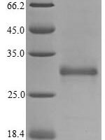 Danio rerio von Willebrand factor C domain-containing protein 2-like (vwc2l) Recombinant Protein, C-Myc/C-His - BioCrest Sci