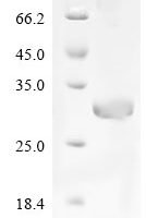 Cat Creatine kinase (CKM), partial Recombinant Protein - BioCrest Sci