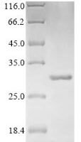 Escherichia coli Beta-lactamase CTX-M-1 (bla) Recombinant Protein - BioCrest Sci