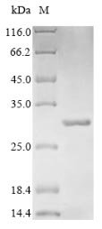 Escherichia coli Beta-lactamase CTX-M-1 (bla) Recombinant Protein, Escherichia coli, Yeast, C-terminal 6xHis-tagged, 30.2 kDa, purity >≥ 85% as determined by SDS-PAGE.