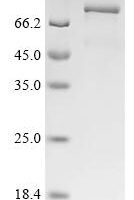 Human Kinesin-like protein KIFC1 (KIFC1) Recombinant Protein - BioCrest Sci