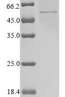 Human coronavirus 229E Nucleoprotein (N) Recombinant Protein, N-10His/C-Myc, aa 1–389, Baculovirus - BioCrest Sci