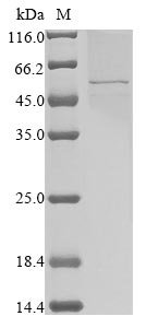 Human coronavirus 229E Nucleoprotein (N) Recombinant Protein, N-10His/C-Myc, aa 1–389, Baculovirus, Human coronavirus 229E (HCoV-229E), Baculovirus, N-terminal 10xHis-tagged and C-terminal Myc-tagged, 47.4 kDa, purity >≥ 85% as determined by SDS-PAGE.