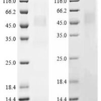 Pig Tumor necrosis factor receptor superfamily member 5 (CD40), partial Recombinant Protein - BioCrest Sci