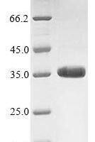 Rotavirus A Outer capsid glycoprotein VP7 Recombinant Protein, N-10His/C-Myc, aa 51–326, strain RVA/Cow/United States/NCDV-Lincoln/1969/G6P6[1] - BioCrest Sci