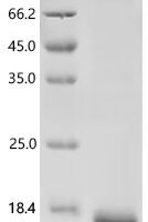 Human Stromal cell-derived factor 1 (CXCL12) Recombinant Protein - BioCrest Sci