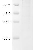 Human NAD-dependent protein deacetylase sirtuin-1 (SIRT1) Recombinant Protein, C-His, aa 2–747, E.coli - BioCrest Sci
