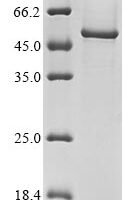 Human EF-hand calcium-binding domain-containing protein 4A (CRACR2B) Recombinant Protein - BioCrest Sci