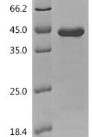 Human TLR adapter interacting with SLC15A4 on the lysosome (TASL) Recombinant Protein - BioCrest Sci