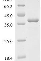 Human NAD (P)H dehydrogenase [quinone] 1 (NQO1) Recombinant Protein - BioCrest Sci
