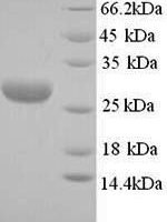Mannheimia haemolytica Leukotoxin (lktA), partial Recombinant Protein - BioCrest Sci