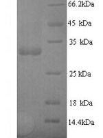 Escherichia coli Type 1 fimbrin D-mannose specific adhesin (fimH) Recombinant Protein, N-His, aa 22–300, Yeast - BioCrest Sci
